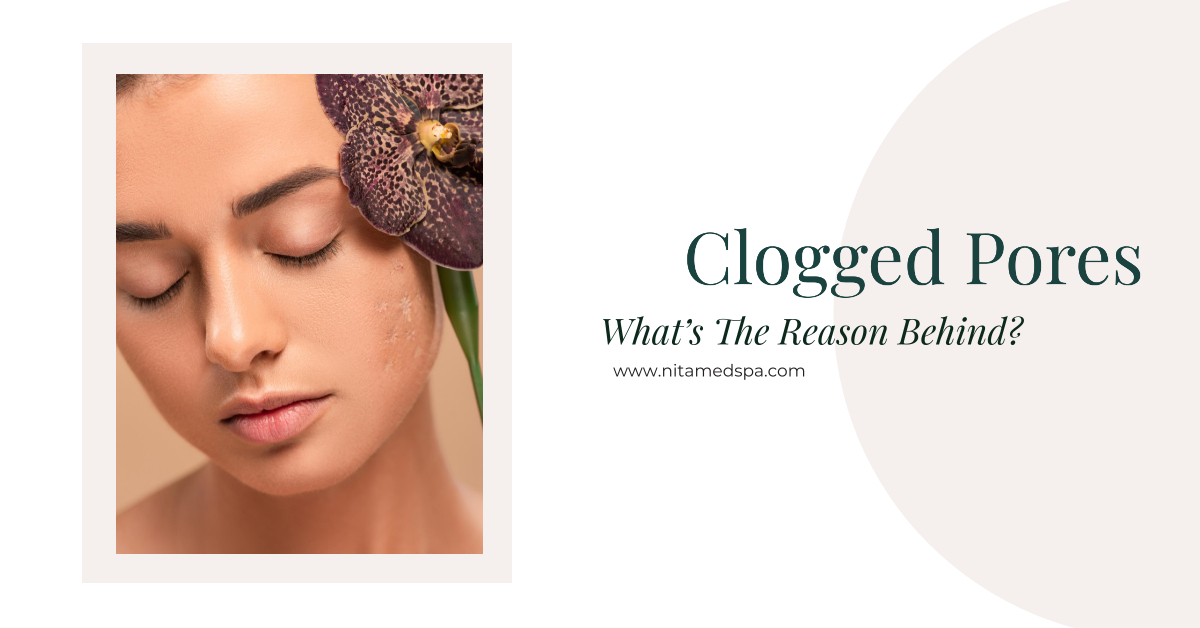 Our skin structure is complex but skincare is even more complex than that. One of the most common skin issues, are enlarged and clogged pores. If you are one of those people who have faced the challenge of clogged pores, then this article is going to be a lifesaver for you. Our experts at Nita Med Spa want you to learn everything about clogged pores and how you can treat them. What Are Pores? So, first thing’s first, what exactly are pores. As you all know our skin consists of layers. The middle layer is responsible for producing sweat. Even though the middle layer has sweat glands, releasing the sweat out of the skin is done through the surface of the skin. It is released through small holes, also known as pores. So, the sweat that you break on a sunny day comes out through these pores. How Do Pores Get Clogged? What makes them clogged? well, dermatologists say that there are three main factors which contribute to the clogging, excess oil (sebum), dead skin cells and over cleansing. When you don’t cleanse your face properly for a long time, dead skin and excess oil starts accumulating on your skin. These in turn, ultimately clog the pores. Ironically, cleansing your skin more than necessary can also become a reason for clogged pores. Since using cleansers remove dirt and oil from your skin, overdoing it can rip off the oil from your skin, alerting your sebaceous glands to produce more oil to compensate. This is why, we suggest following a balanced cleansing routine. Using the right kind of product at the right time will certainly make a difference. Washing your face morning and evening is recommended for people with oily to normal skin. However, someone with a dry skin should do that only once or as per their dermatologist’s suggestion. Some Common Myths Debunked For You While we are at it, let us tell you about some common misconceptions about clogged and enlarged pores. • Unlike common belief, pores don’t get enlarged. They only appear to be enlarged when dirt and oil fills them up. • You cannot close your pores with a toner. The truth is, your pores are always open. They get clogged and steam and other agents are used to unclog them but they are never closed. • Blackheads are not dirt. In fact, when dirt and oil clog a pore, it oxidizes and cause the tip to turn black. Another important thing is to understand the difference between a blackhead and sebaceous filament as you need to treat them differently. How To Unclog Pores? Building a healthy and balanced skincare routine is the key to flawless skin. Choosing the right cleanser is at the top of the list. However, a cleanser alone is not enough. Pick The Right Facial A deep pore cleansing with exfoliation is a must for keeping the pores from being clogged. Our hydrafacial is an excellent choice for all skin issues including acne and clogged pores. This 5 steps facial is known for its miraculous benefits. And lucky for you, we are offering our summer specials. Now you can have a package of 3 hydrafacial with mask at only $750. This is your chance to keep your pores clean, have a flawless skin and save over $350 bucks. So, book your appointment today!