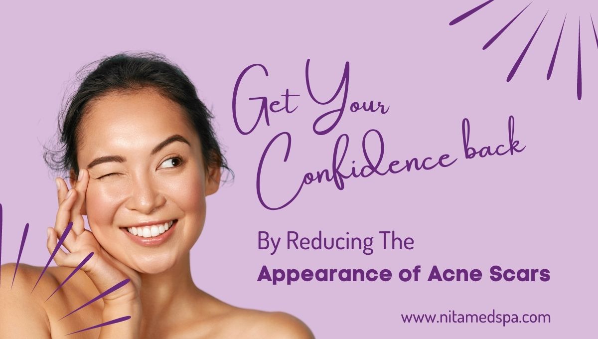 reduce appearance of scars in houston tx